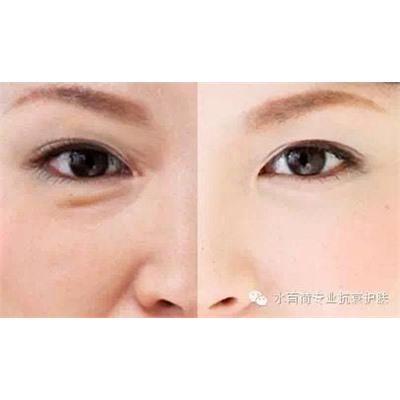 Сыворотка вокруг глаз Collagen Anti-Aging Eye Serum , 20 мл